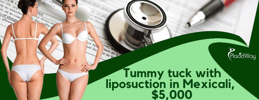 Tummy tuck with liposuction in Mexicali, Mexico Cost
